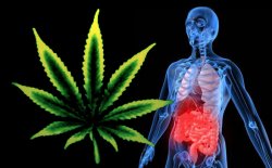 Treating Digestive Issues With Cannabis