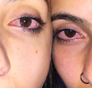 red eyes, Cannabis Newbies, trying marijuana for the first time, marijuana legalization