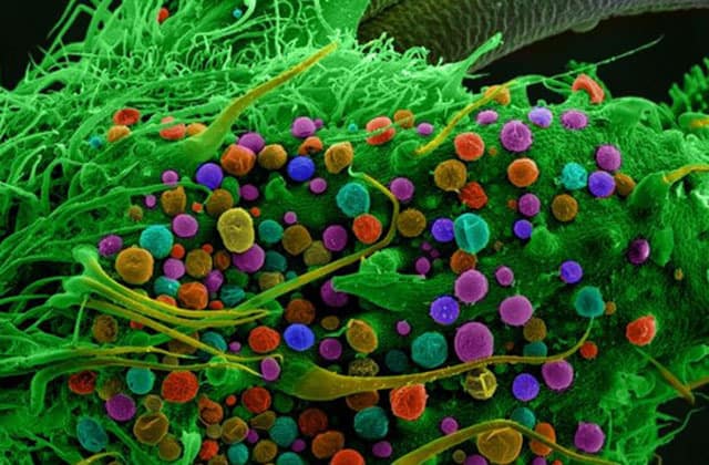 Learning To Interpret Terpenes Can Make You A Cannabis Connoisseur