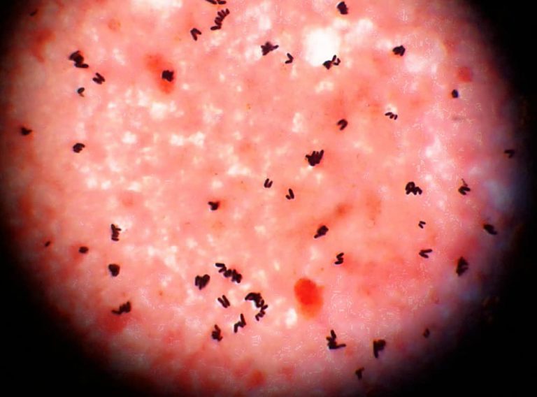 5 Ways Your Weed Could Be Contaminated